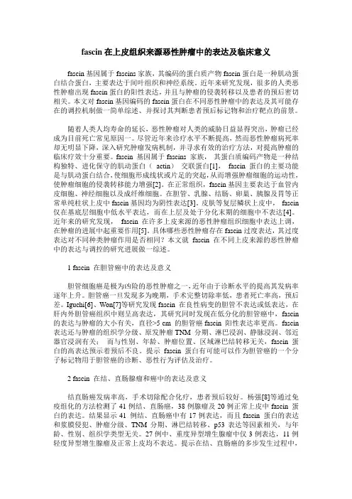 fascin在上皮组织来源恶性肿瘤中的表达及临床意义