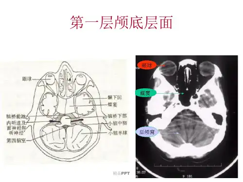 颅脑基本病变的CT诊断