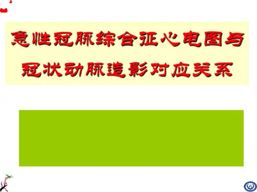 急性冠脉综合征心电图与冠状动脉造影对应关系