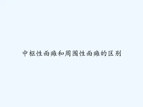 中枢性面瘫和周围性面瘫的区别 PPT