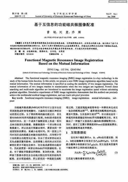 基于互信息的功能磁共振图像配准