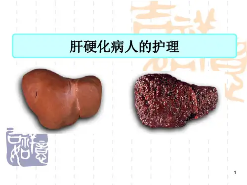 肝硬化病人的护理 ppt课件