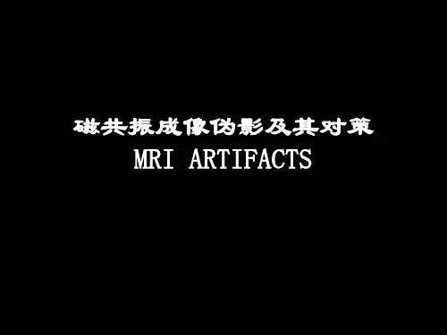磁共振成像伪影