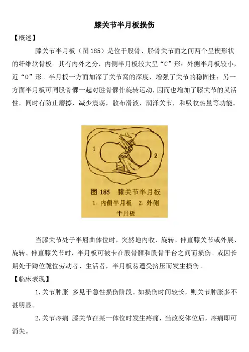 膝关节半月板损伤机理与中医治疗讲解