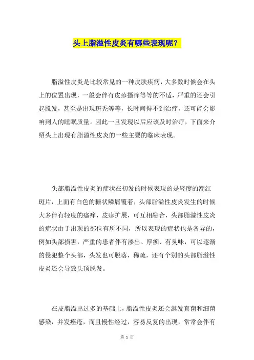 头上脂溢性皮炎有哪些表现呢？