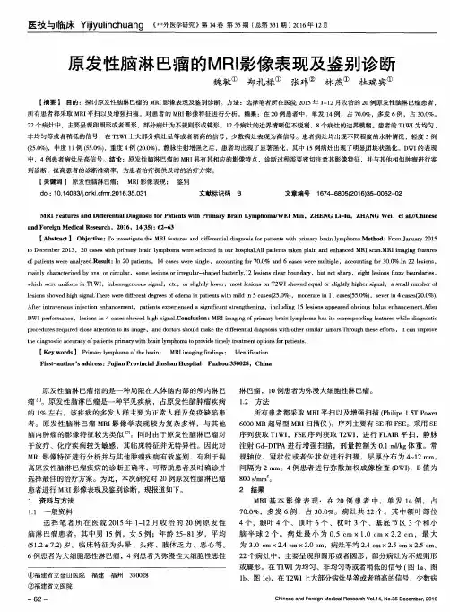 原发性脑淋巴瘤的MRI影像表现及鉴别诊断
