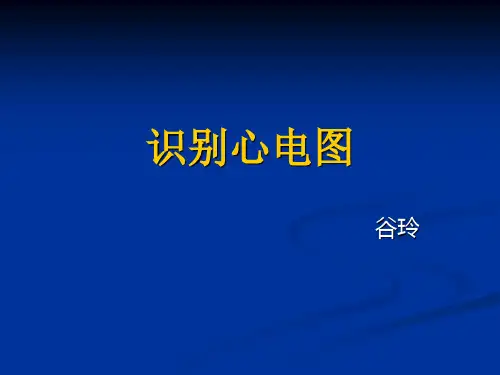 心电图2