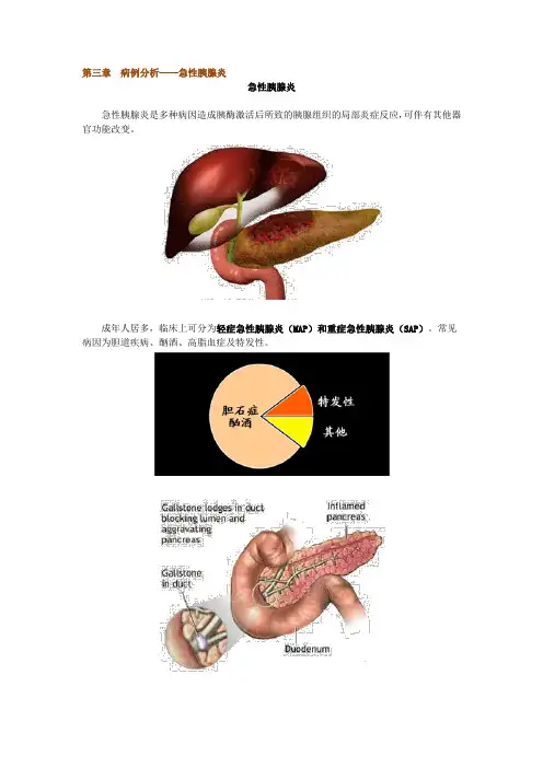 第三章 病例分析——急性胰腺炎