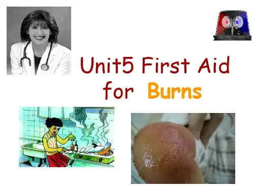 unit5 first aid for burns