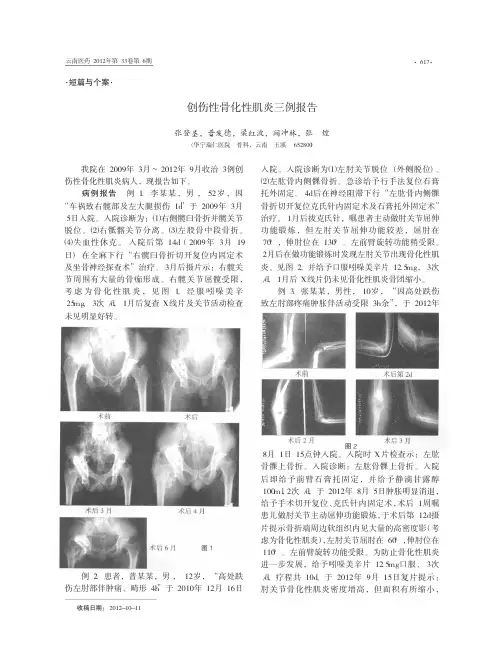 创伤性骨化性肌炎三例报告