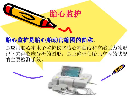 胎心监护 ppt课件