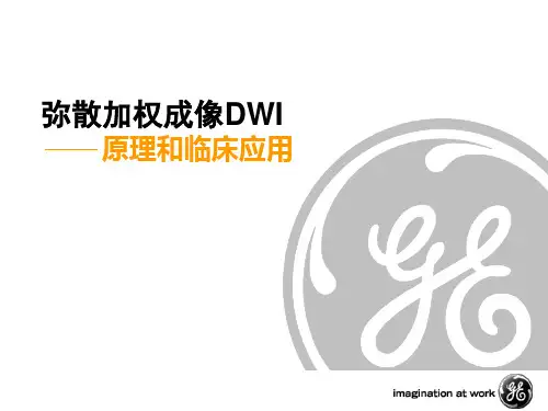 DWI.DTI的原理和临床应用