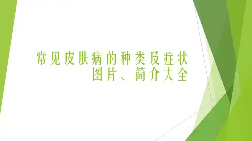 常见皮肤病的种类及症状图片简介大全ppt课件