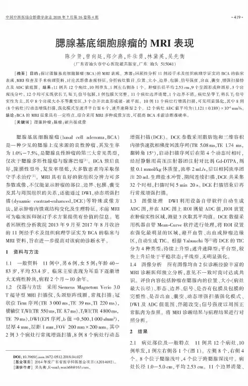 腮腺基底细胞腺瘤的MRI表现