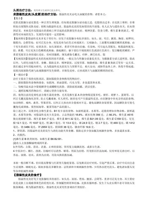 头屑治疗方法