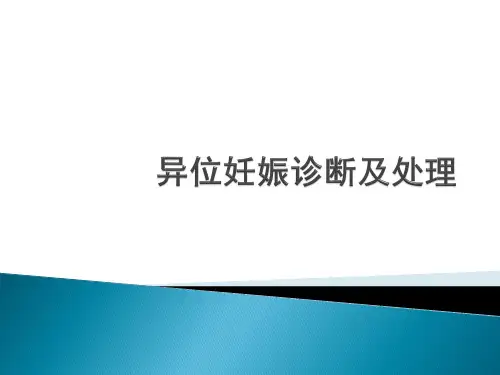 异位妊娠诊断及处理