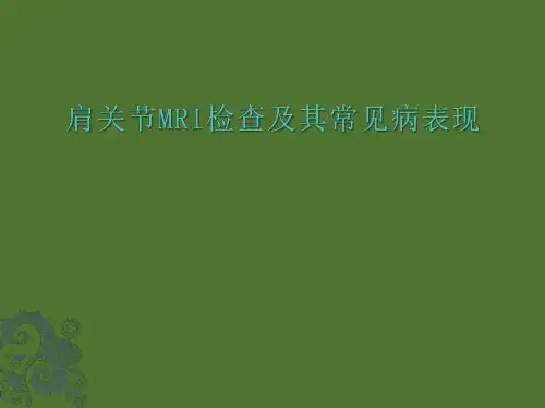 肩关节MRI检查及其常见病的表现