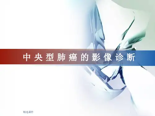 中央型肺癌的影像诊断