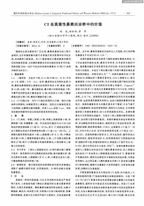 CT在真菌性鼻窦炎诊断中的价值