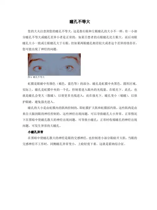 瞳孔不等大