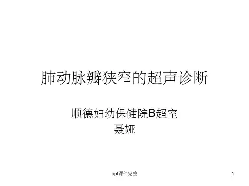 肺动脉瓣狭窄的超声ppt课件