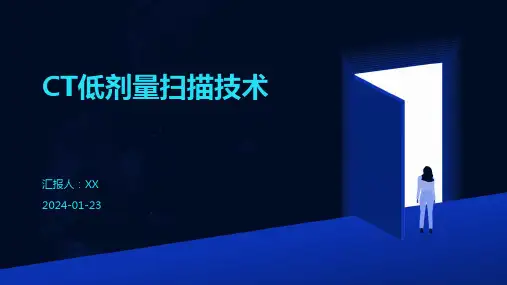 CT低剂量扫描技术