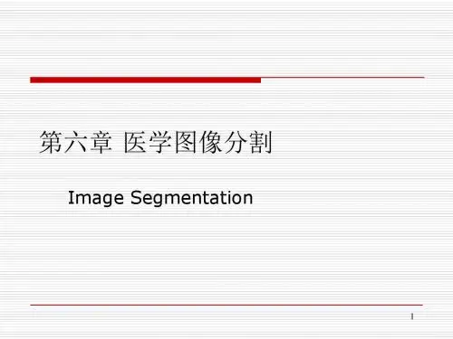 CT成像资料