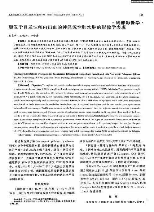继发于自发性颅内出血的神经源性肺水肿的影像学表现