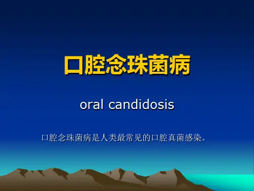口腔念珠菌病