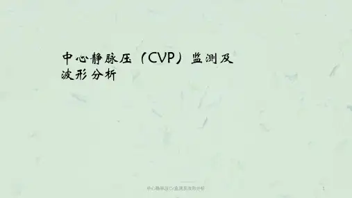 中心静脉压CV监测及波形分析课件