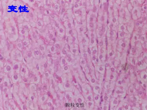 病理图片