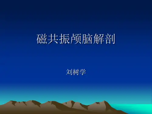 脑部mri断面解剖ppt课件