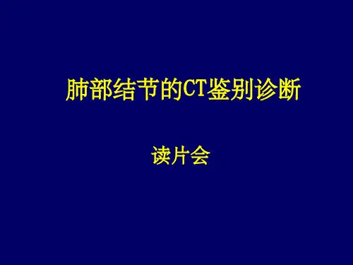 肺部结节的CT鉴别诊断