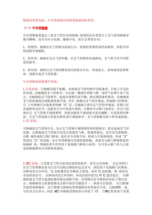肺癌的分类及影像学鉴别诊断 2