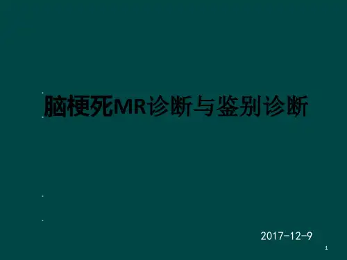 脑梗死MR诊断及鉴别诊断PPT课件