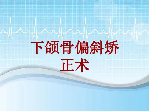 手术讲解模板:下颌骨偏斜矫正术