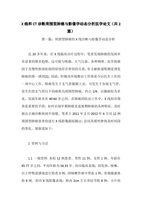 X线和CT诊断周围型肺癌与影像学动态分析医学论文(共2篇)