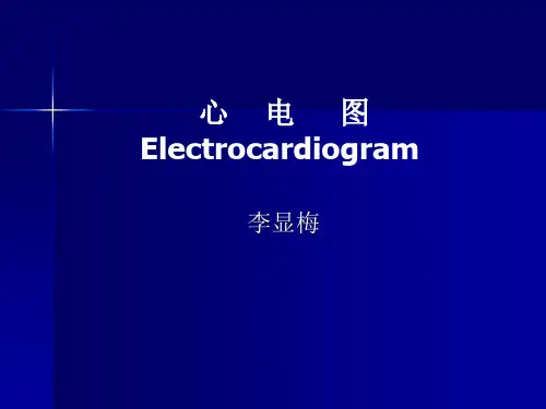 快速看懂心电图