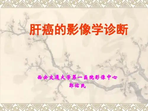 肝癌的影像学诊断ppt