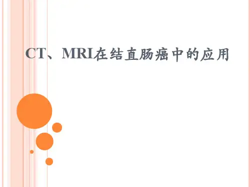 CT、MRI在结直肠癌中的