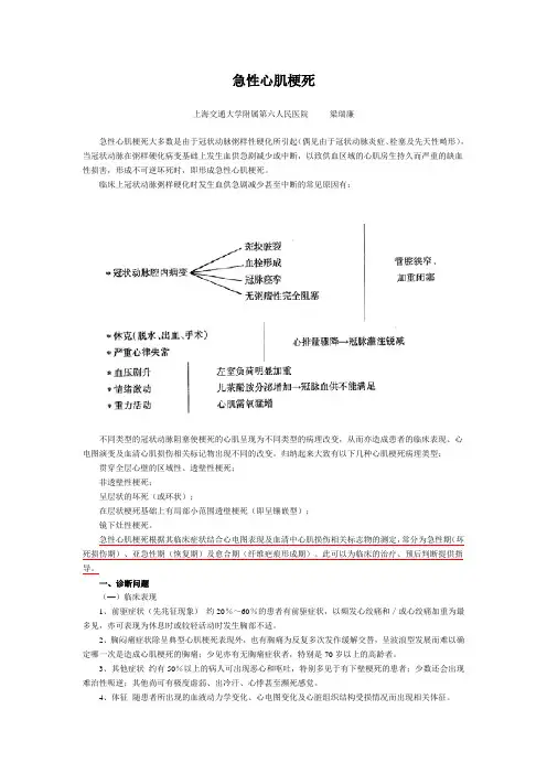 急性心肌梗死