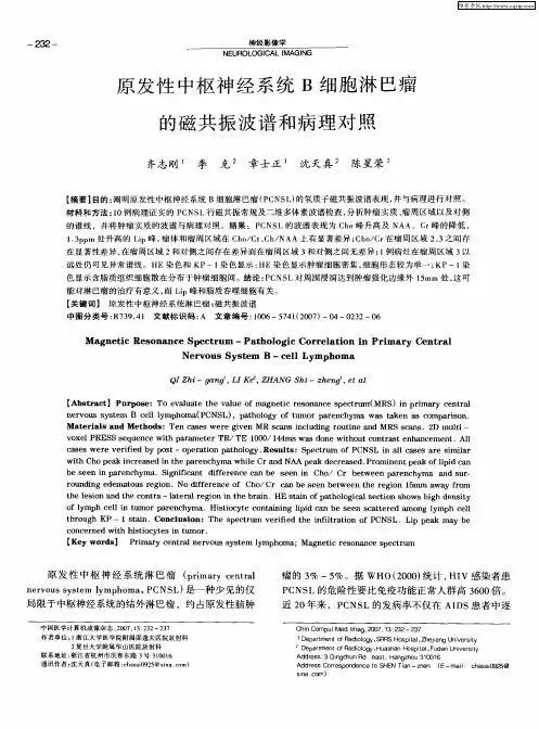 原发性中枢神经系统B细胞淋巴瘤的磁共振波谱和病理对照