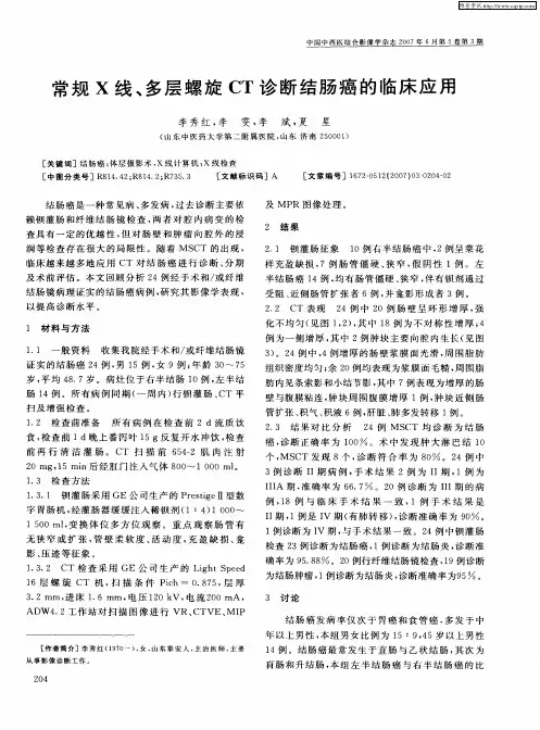 常规X线、多层螺旋CT诊断结肠癌的临床应用