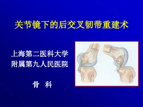 关节镜下的后交叉韧带重建术PPT课件