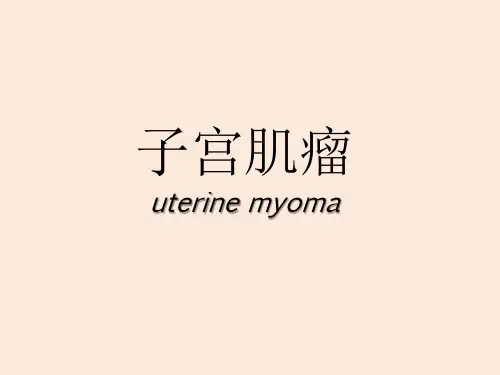 子宫肌瘤授课课件