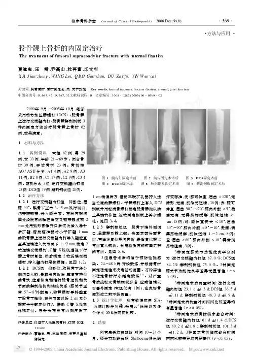 股骨髁上骨折的内固定治疗