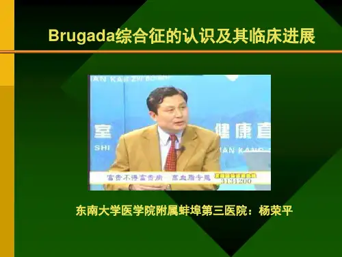 Brugada综合症的认识及其临床进展