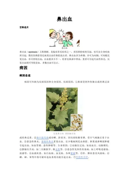 鼻出血