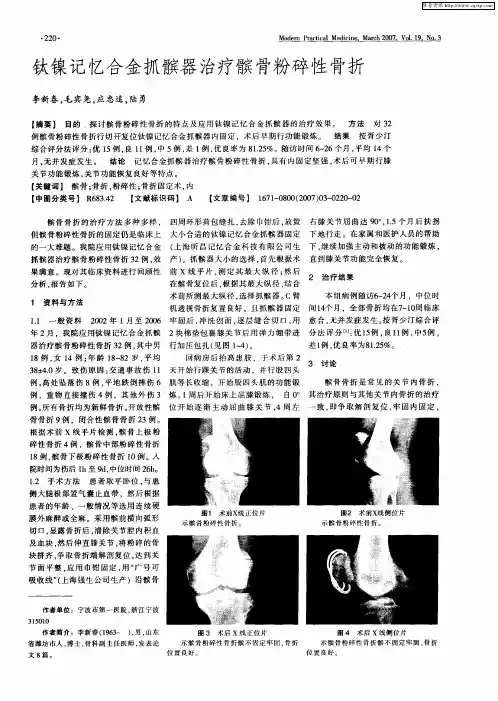 钛镍记忆合金抓髌器治疗髌骨粉碎性骨折