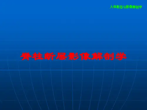 脊柱断层影像解剖学培训课件